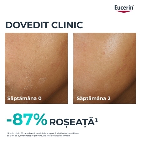 Fluid pentru fata hidratant DermoPure, 40 ml, Eucerin
