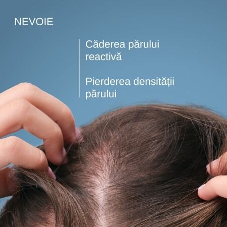 Sampon complementar impotriva caderii parului Anaphase, 200 ml, Ducray